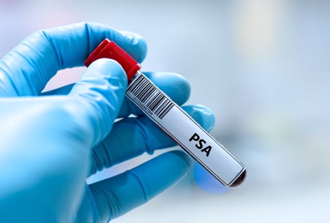 Blood sample tube for prostate specific antigen test analysis